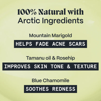 Pimple Scars Balm 2.0